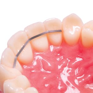 Dead Soft Retention Wire